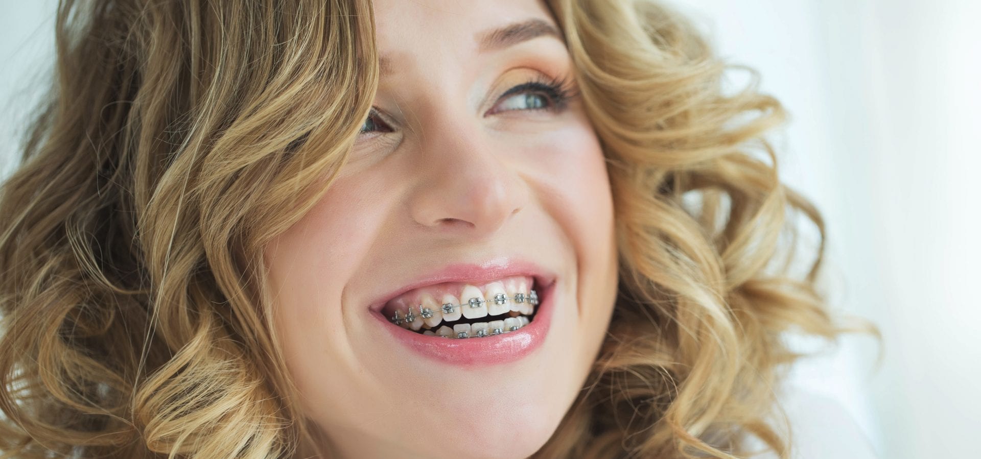 living with braces | Crane & Seager Orthodontics in Fort Collins and Loveland, CO